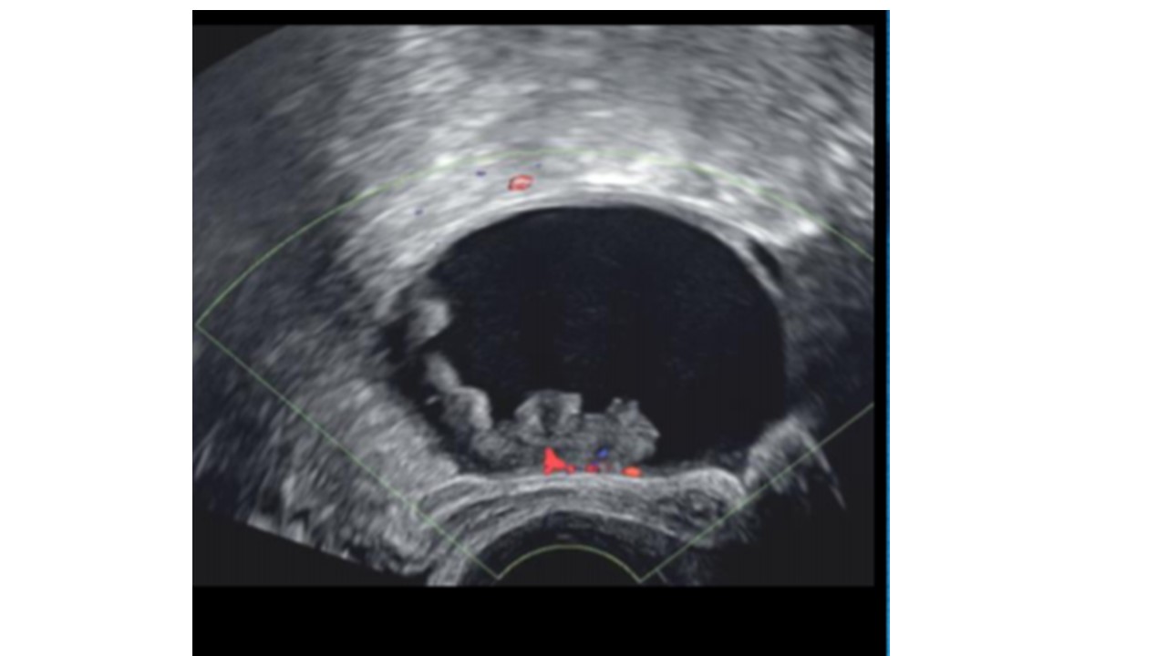 Echographie Radiologie Corinne Bordonne
